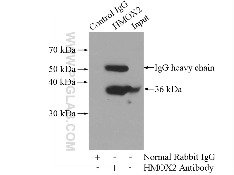 IP experiment of Raji using 14817-1-AP