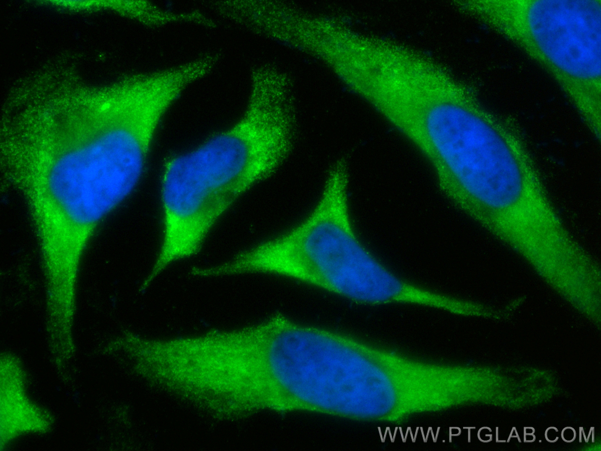 IF Staining of HeLa using CL488-14817