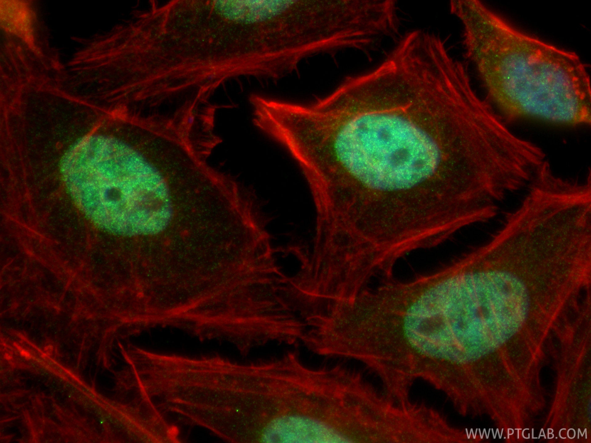 IF Staining of HeLa using 34183-1-AP (same clone as 34183-1-PBS) IF Staining of HeLa using 34183-1-AP (same clone as 34183-1-PBS)