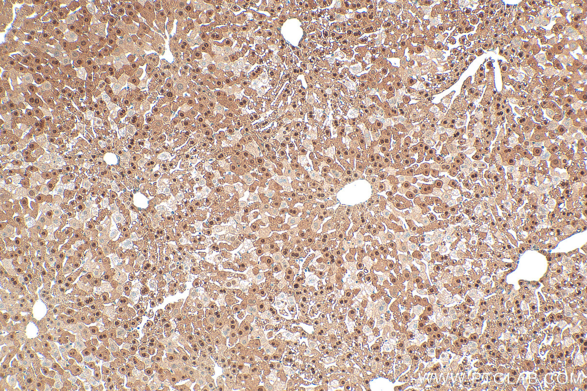 IHC staining of mouse liver using 34183-1-AP (same clone as 34183-1-PBS) IHC staining of mouse liver using 34183-1-AP (same clone as 34183-1-PBS)