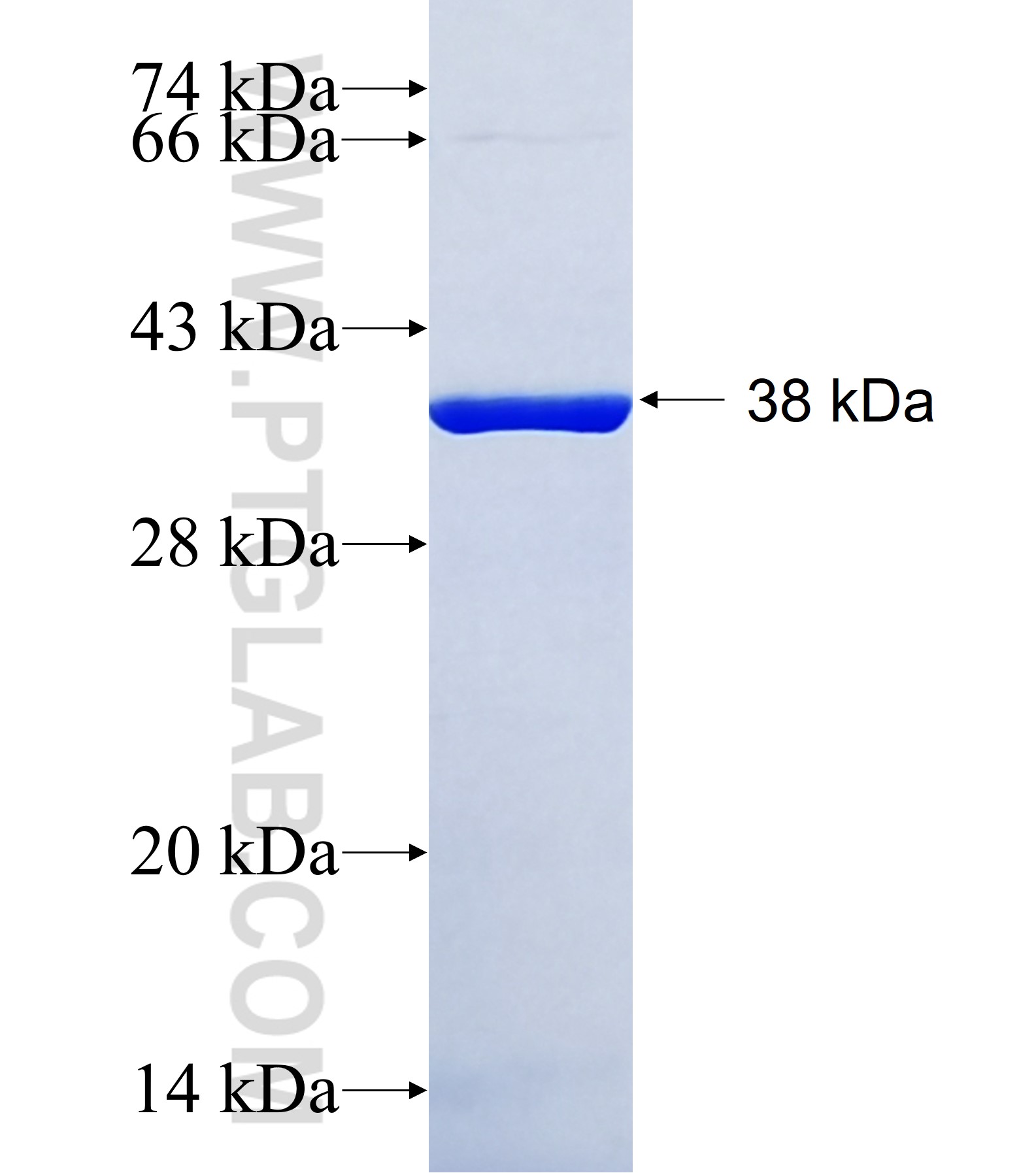 HMX3 fusion protein Ag41398 SDS-PAGE HMX3 fusion protein Ag41398 SDS-PAGE