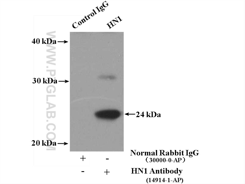 IP experiment of MCF-7 using 14914-1-AP