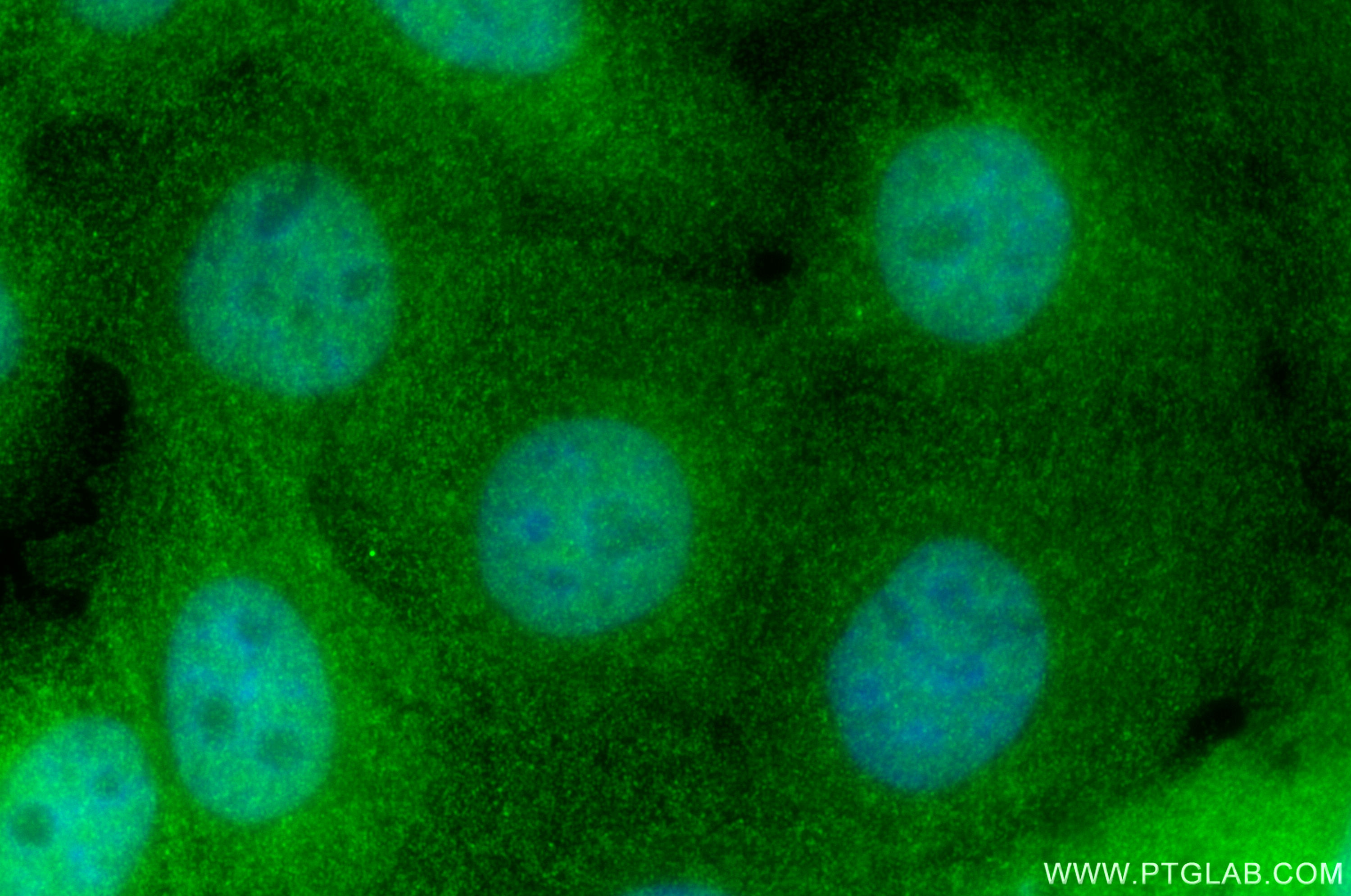 IF Staining of A431 using 16285-1-AP