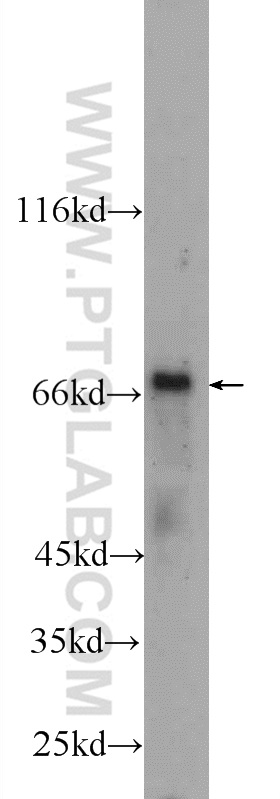 WB analysis of rat liver using 22426-1-AP