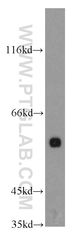 WB analysis of L02 using 12533-1-AP