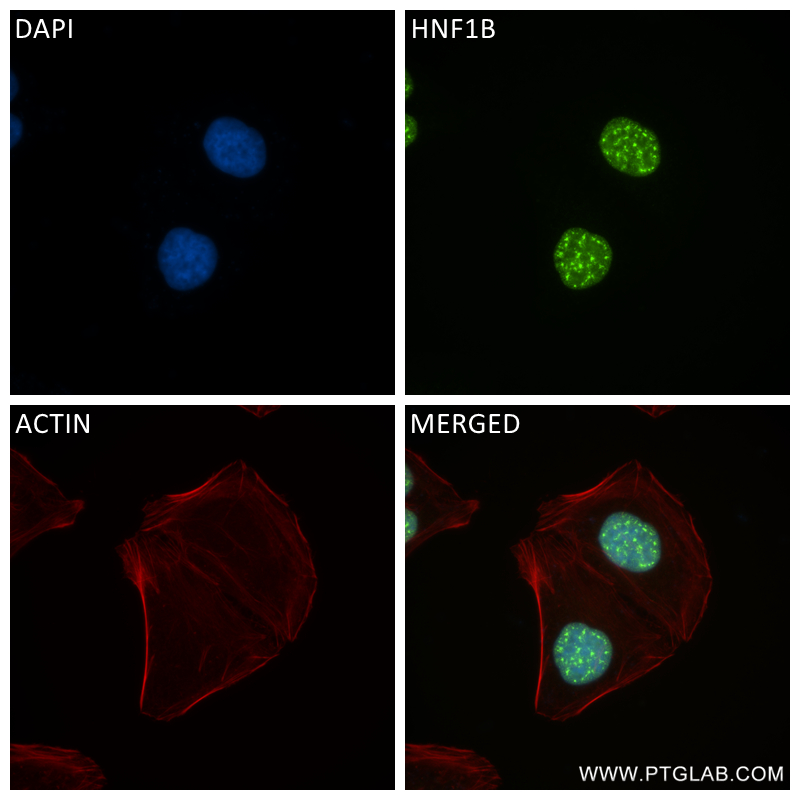 IF Staining of HepG2 using 84684-5-RR