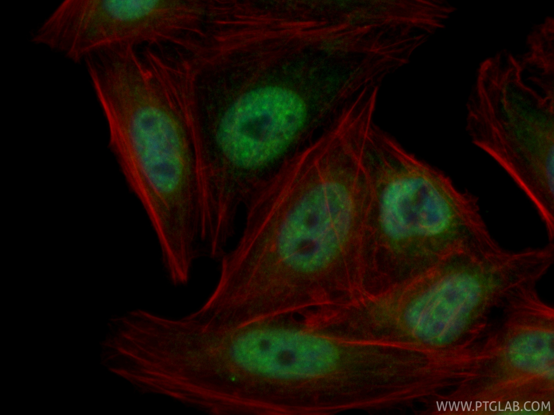 IF Staining of HepG2 using CL488-84684-5