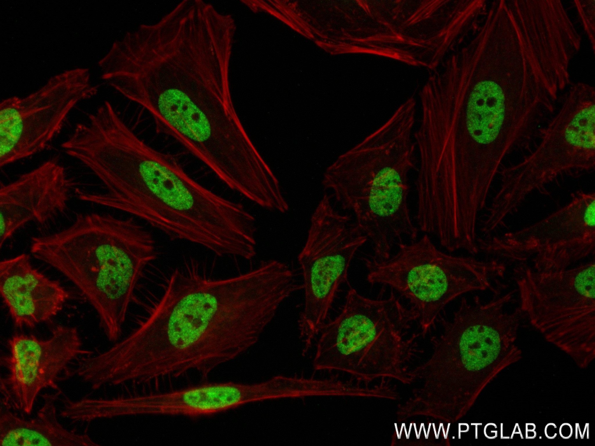IF Staining of HeLa using 84316-7-RR
