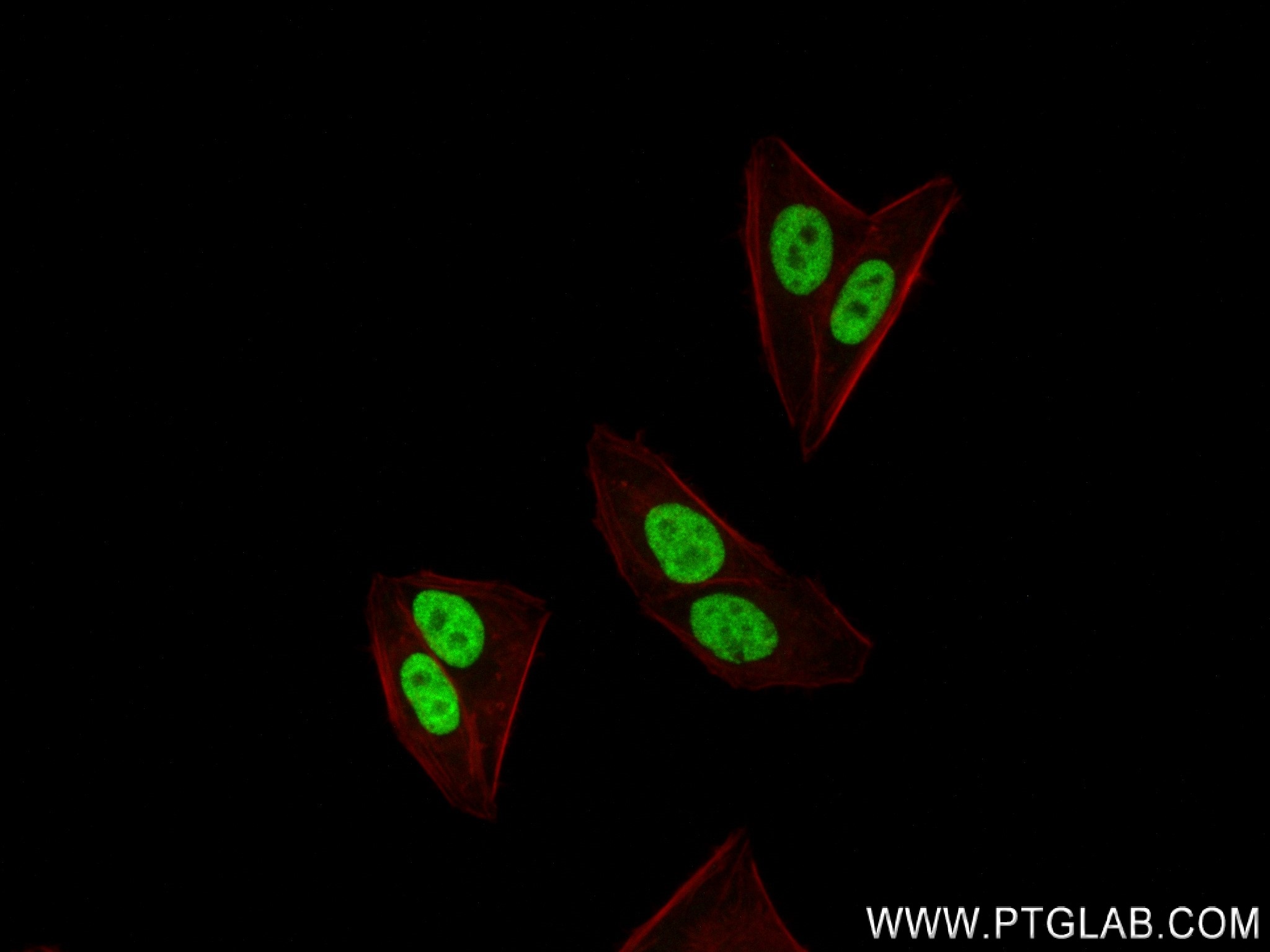 IF Staining of HepG2 using 84316-7-RR
