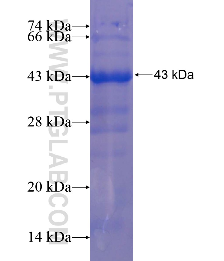 HNRNPA1 fusion protein Ag17415 SDS-PAGE