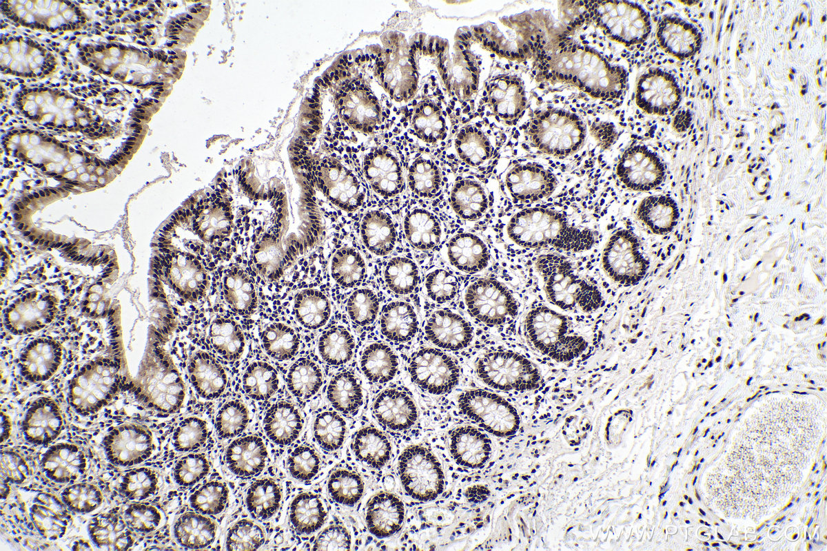 IHC staining of human colon using 67445-1-Ig