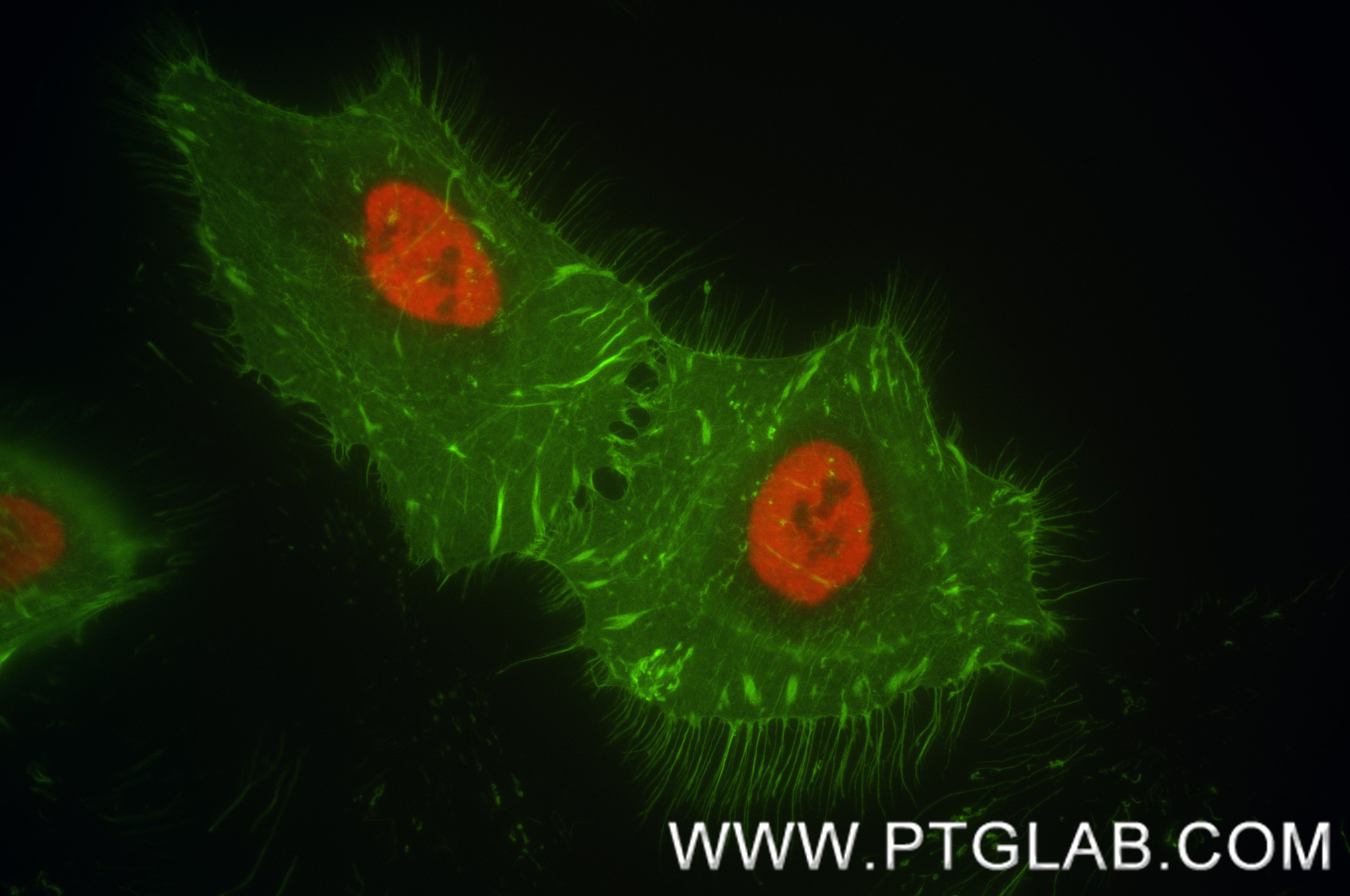 IF Staining of HeLa using 86713-1-MR (same clone as 86713-1-PBS) IF Staining of HeLa using 86713-1-MR (same clone as 86713-1-PBS)