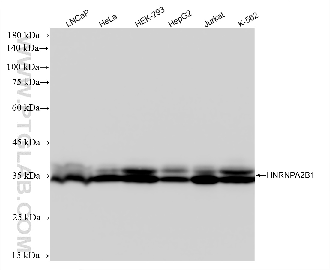 WB analysis using 86713-1-MR (same clone as 86713-1-PBS) WB analysis using 86713-1-MR (same clone as 86713-1-PBS)