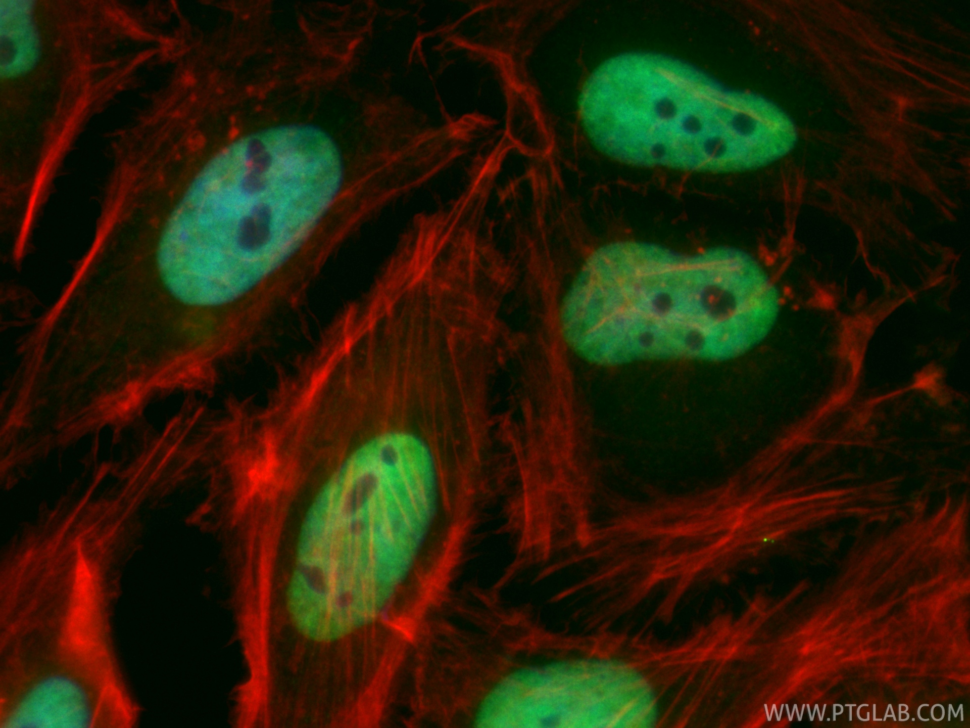 IF Staining of HeLa using CL488-86713 IF Staining of HeLa using CL488-86713