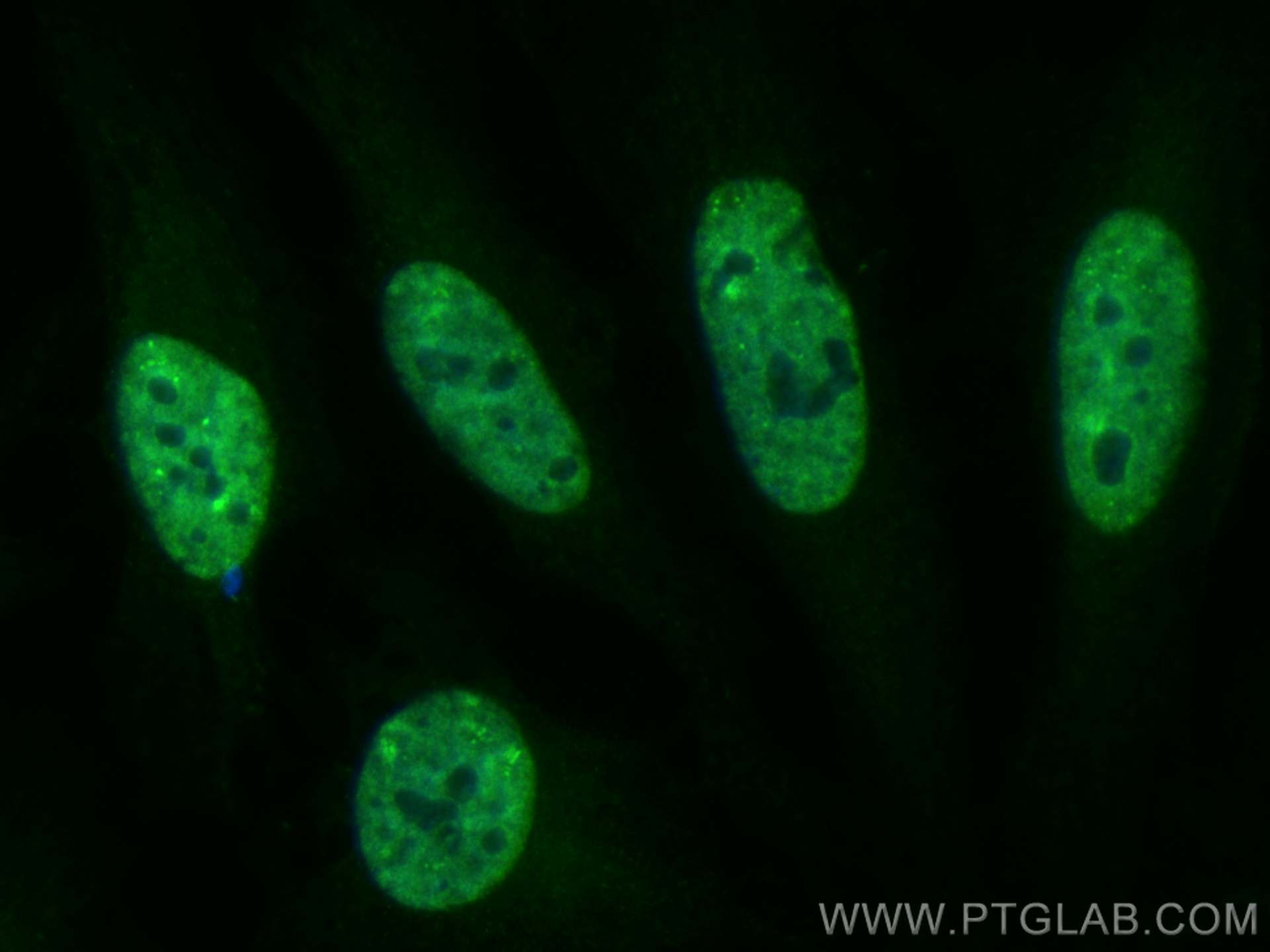 IF Staining of HeLa using CL488-25142