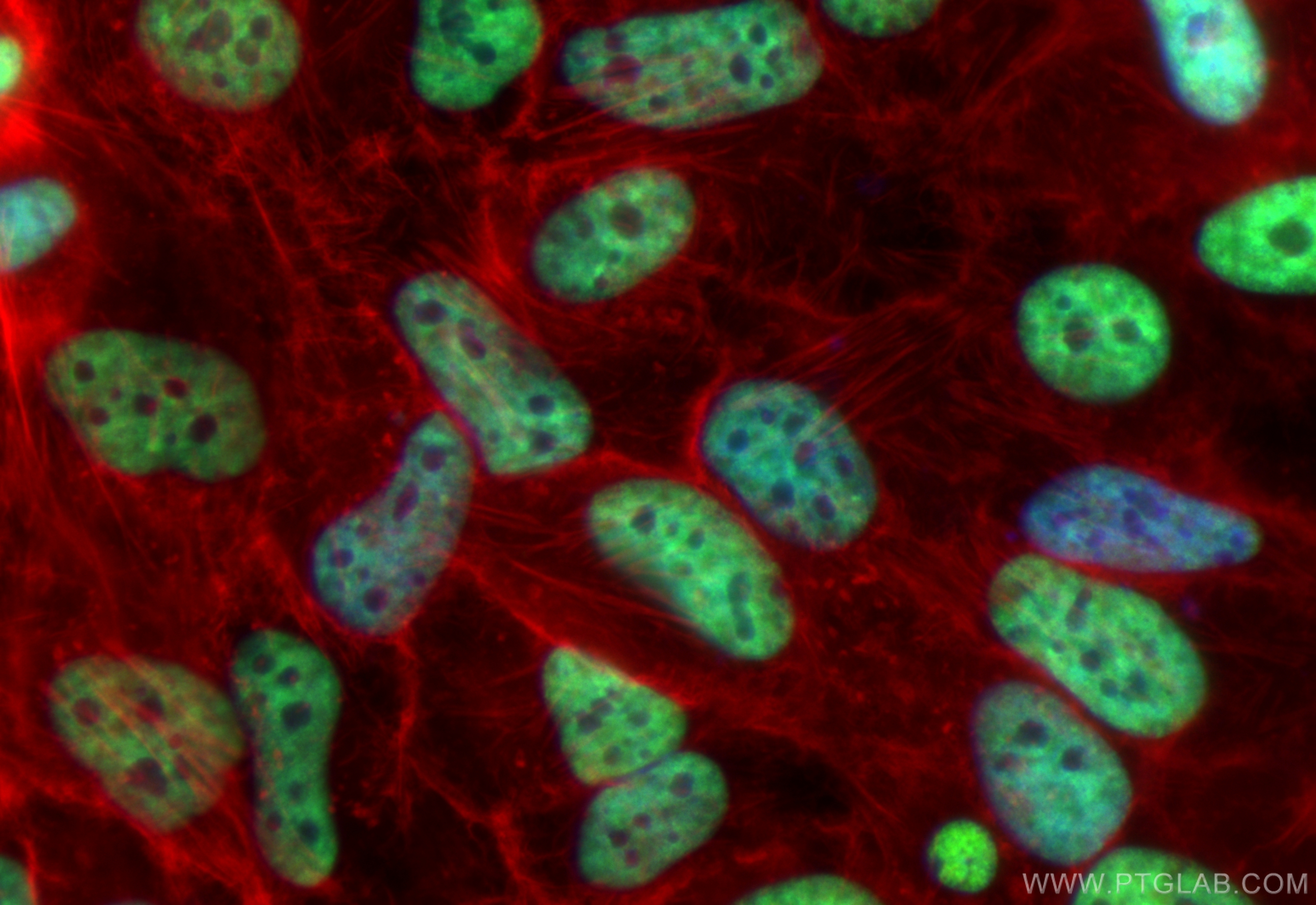 IF Staining of HeLa using CL488-84207