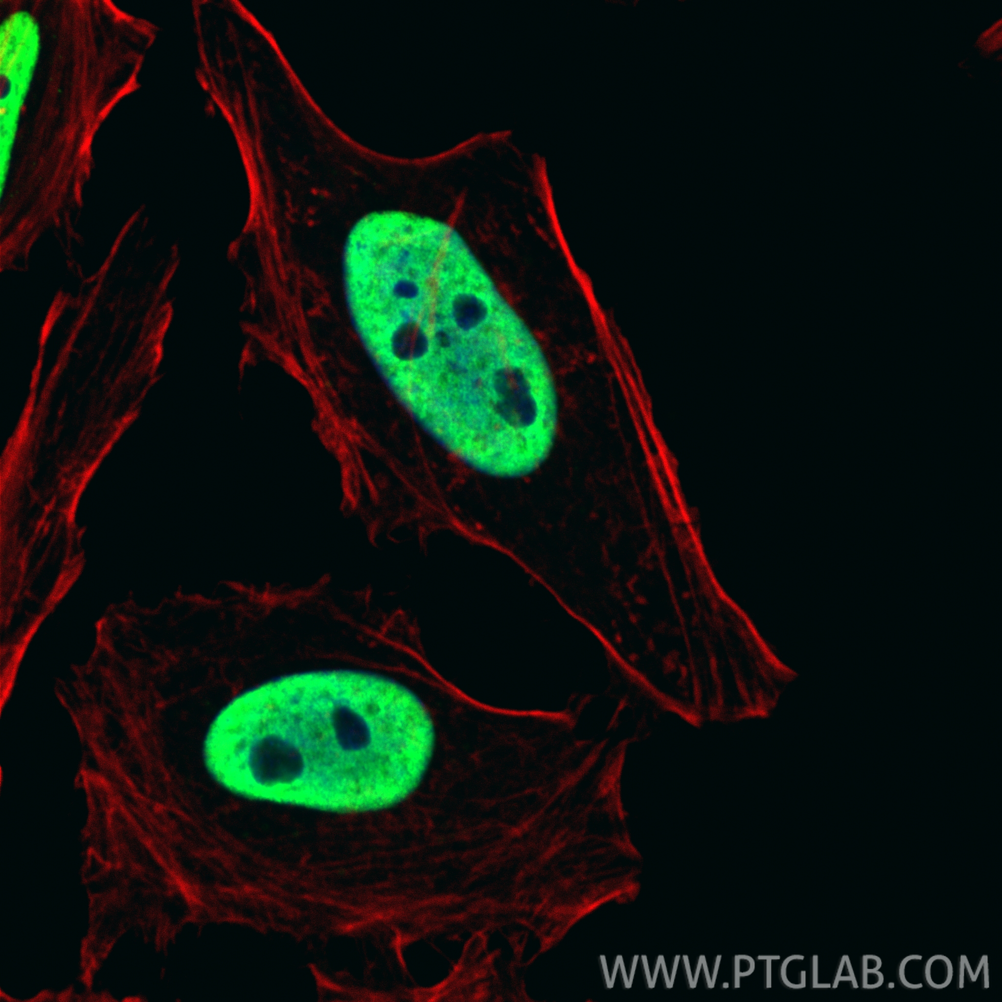 IF Staining of HeLa using 11760-1-AP IF Staining of HeLa using 11760-1-AP