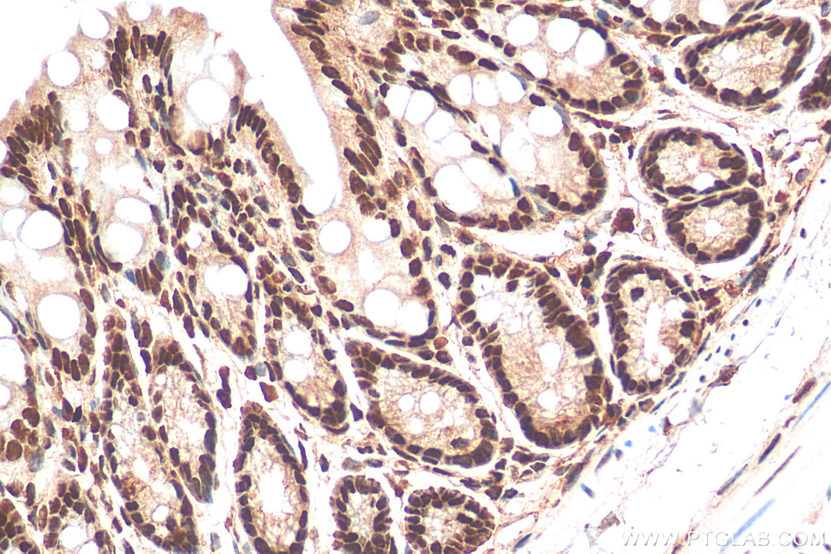 IHC staining of mouse colon using 11760-1-AP