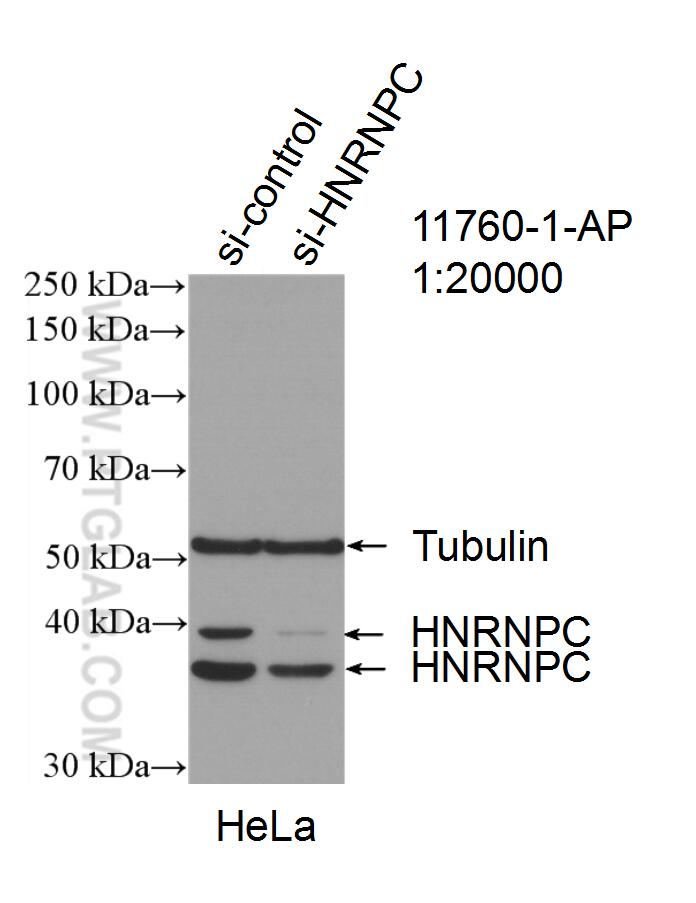 WB analysis of HeLa using 11760-1-AP