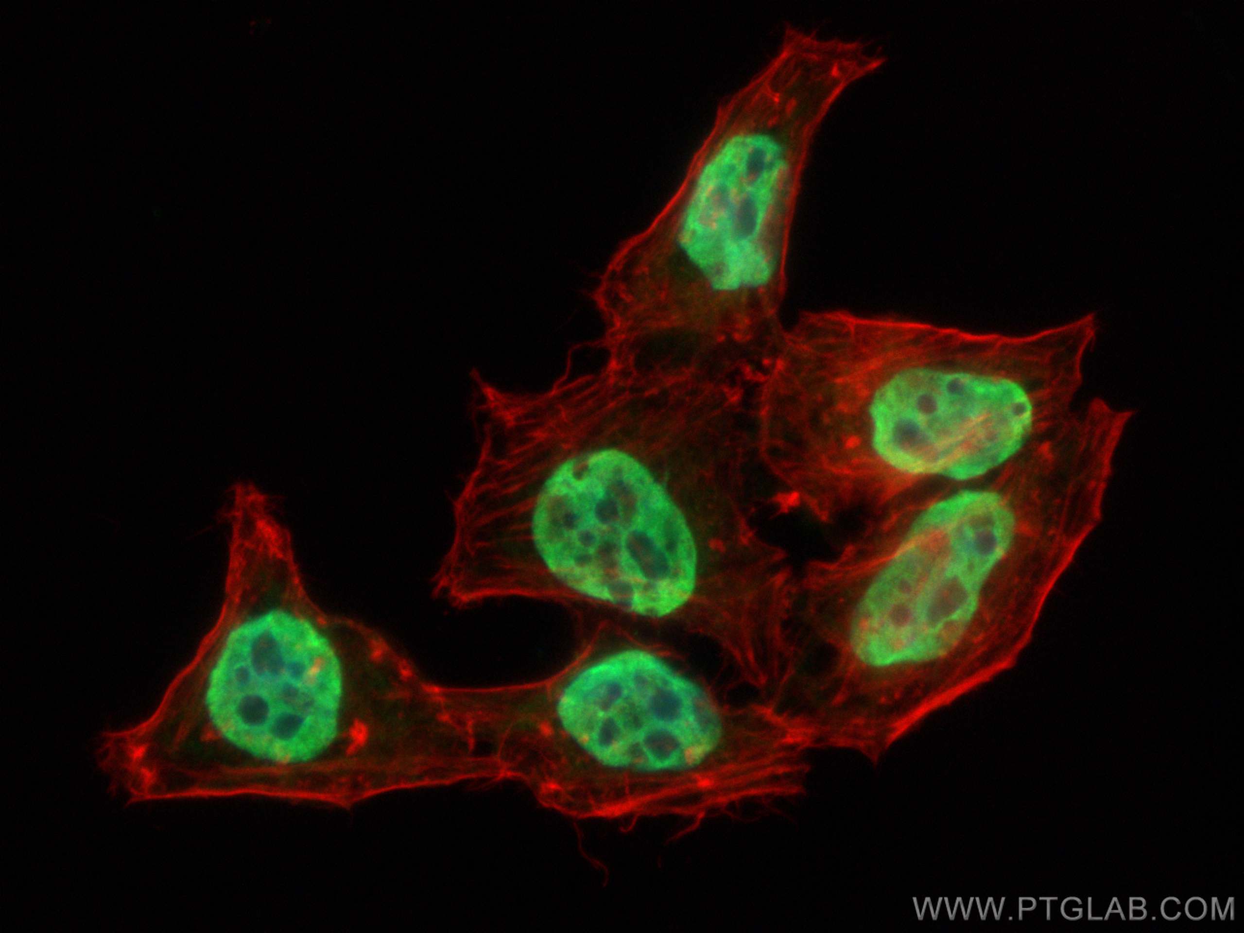 IF Staining of HepG2 using 12770-1-AP