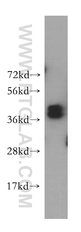 HNRNPD Polyclonal antibody