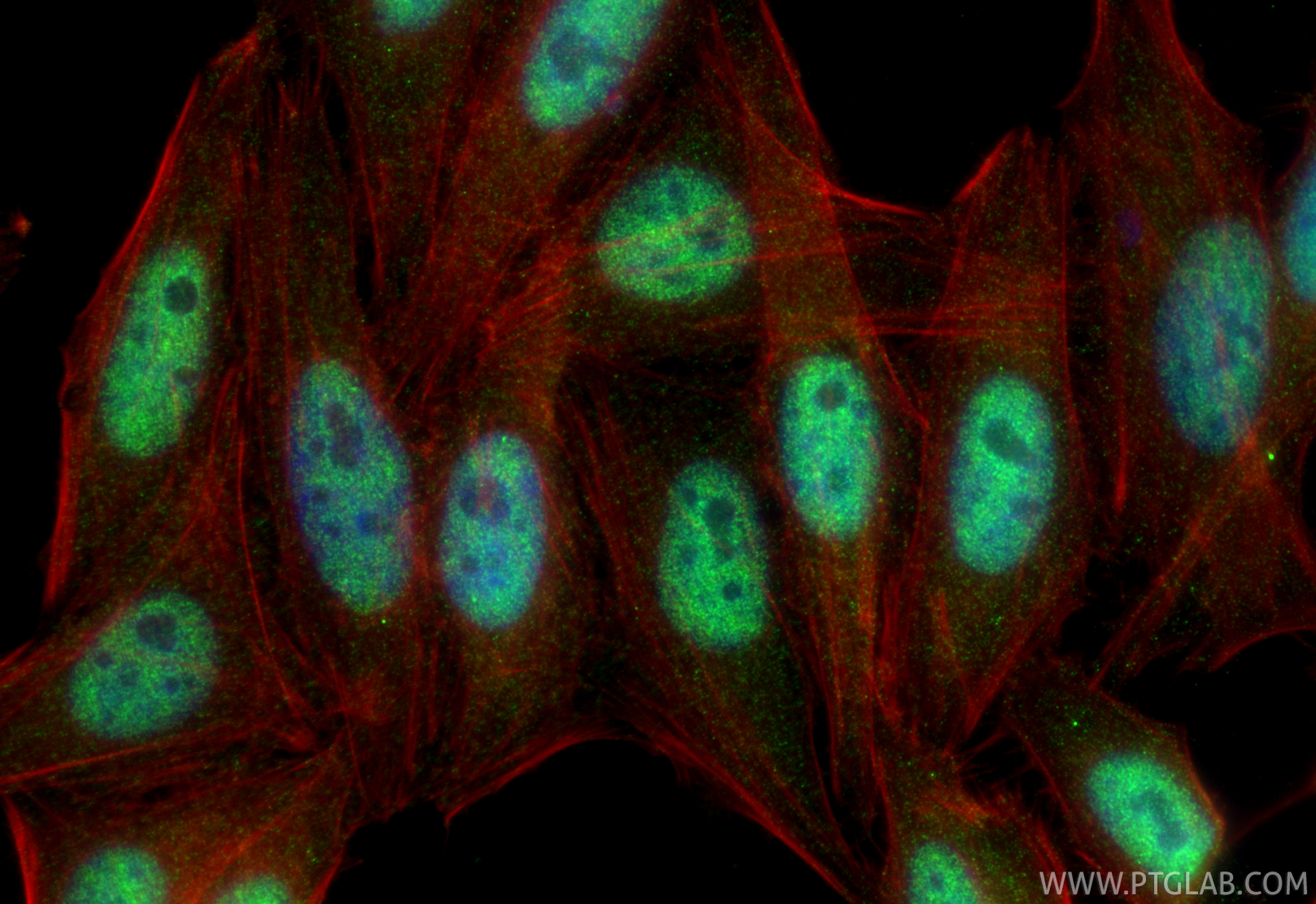 IF Staining of HepG2 using 14774-1-AP IF Staining of HepG2 using 14774-1-AP