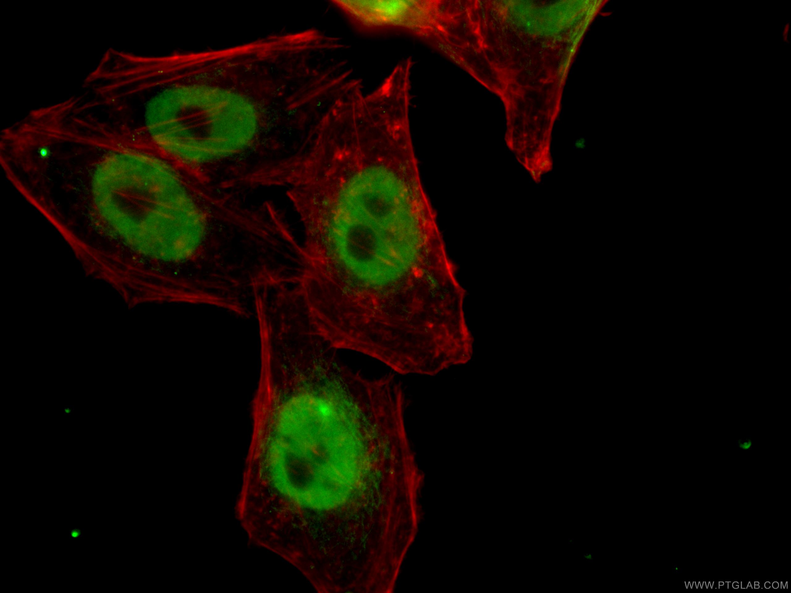 IF Staining of HepG2 using 67375-1-Ig