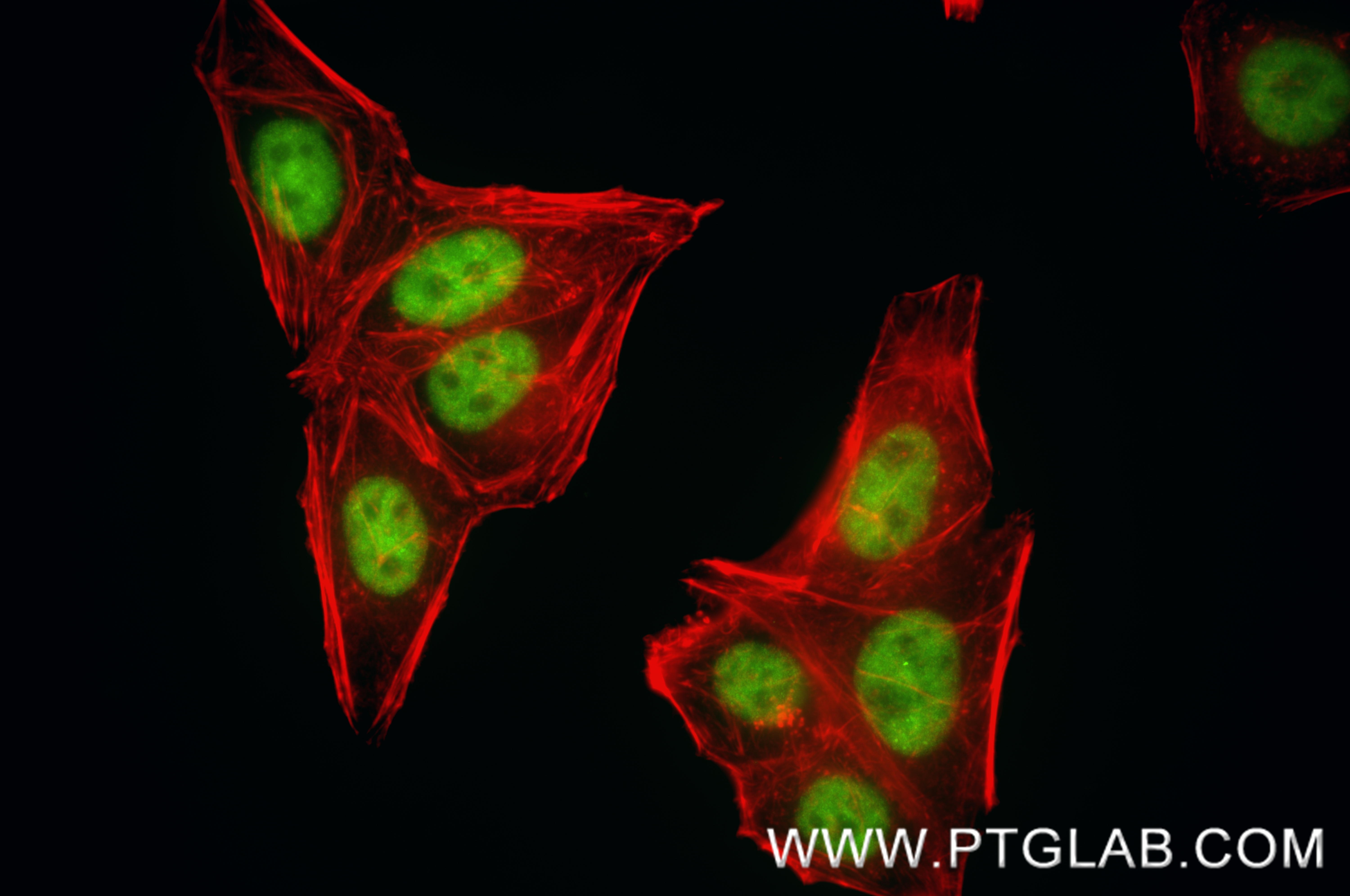IF Staining of HepG2 using 88017-1-RR (same clone as 88017-1-PBS)
