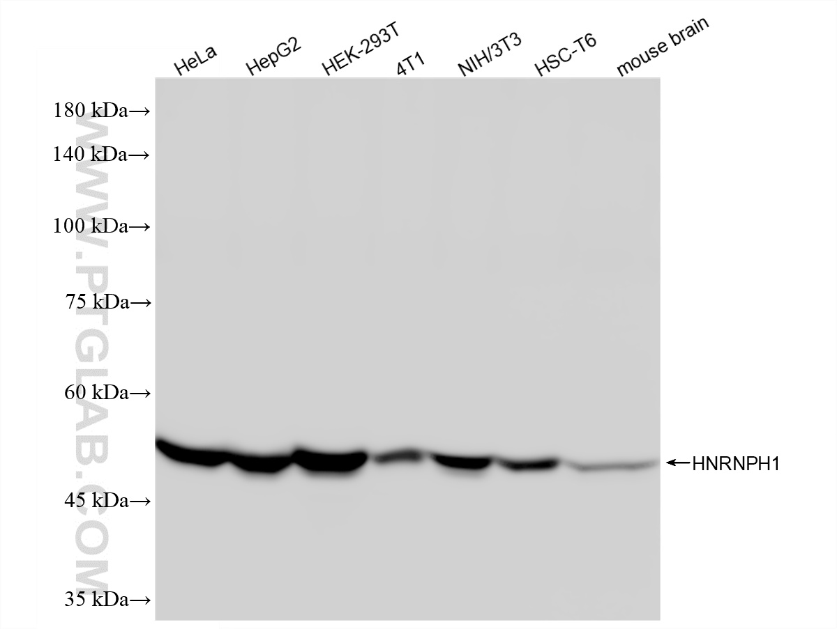 WB analysis using 88017-1-RR (same clone as 88017-1-PBS)