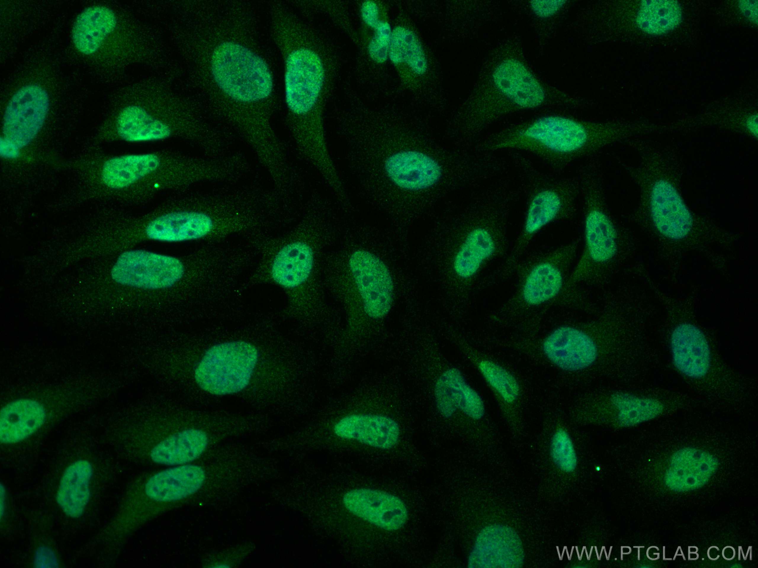 IF Staining of HeLa using 11426-1-AP