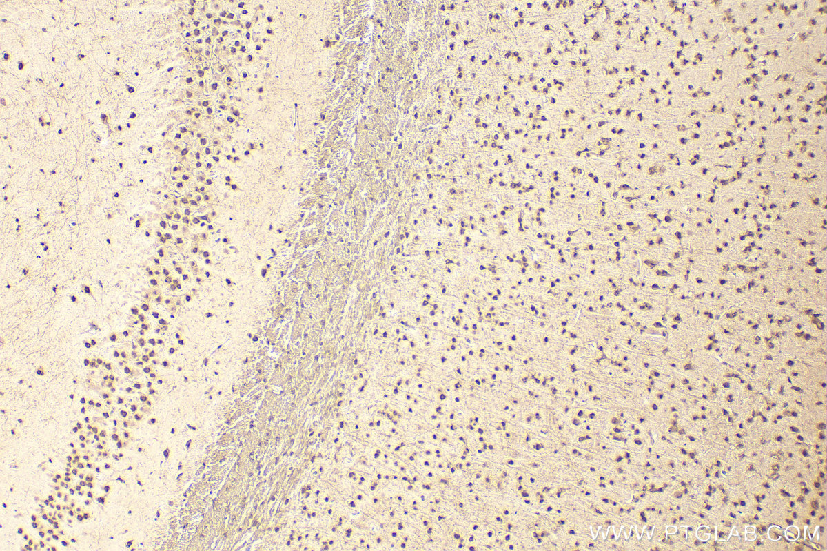 IHC staining of mouse brain using 11426-1-AP