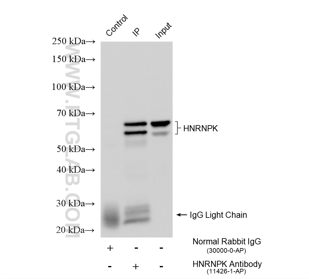 IP experiment of HeLa using 11426-1-AP IP experiment of HeLa using 11426-1-AP
