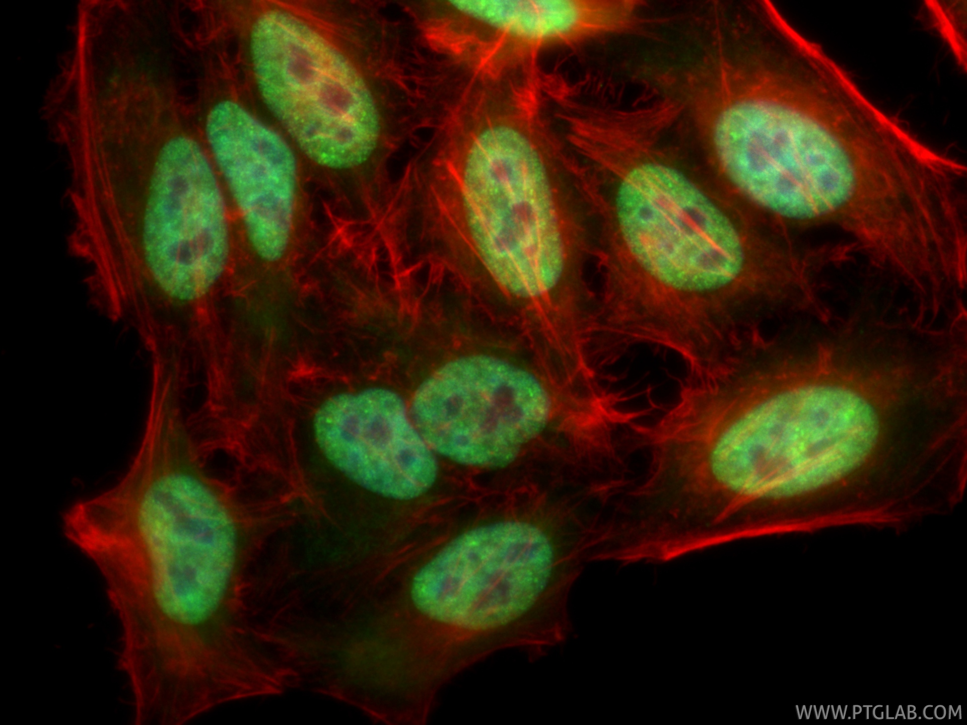 IF Staining of HepG2 using CL488-85422