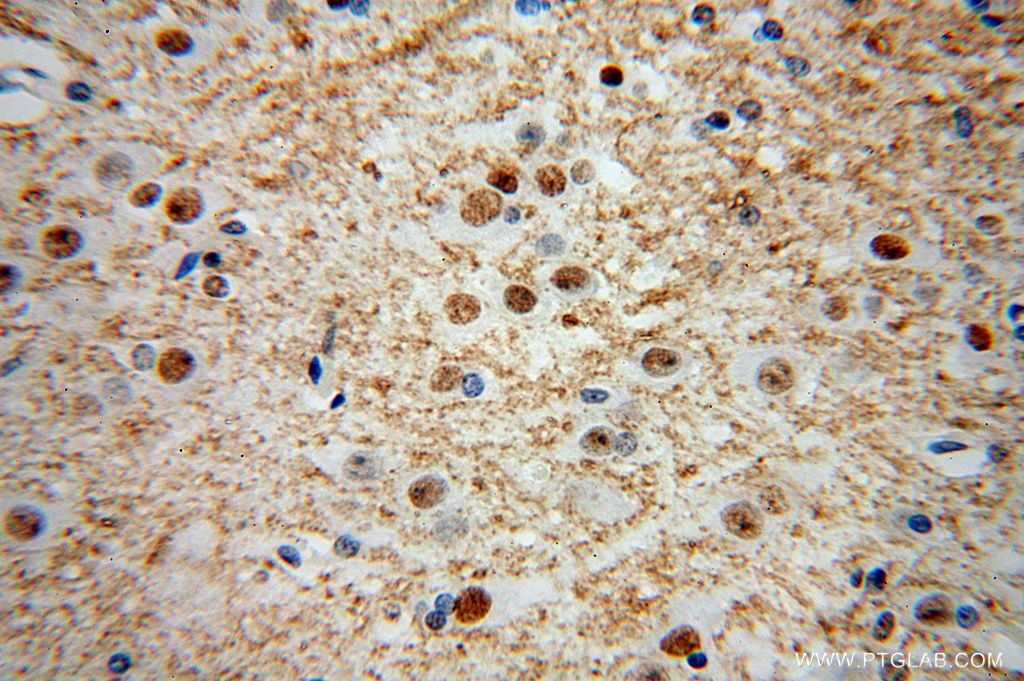 IHC staining of human brain using 15018-1-AP
