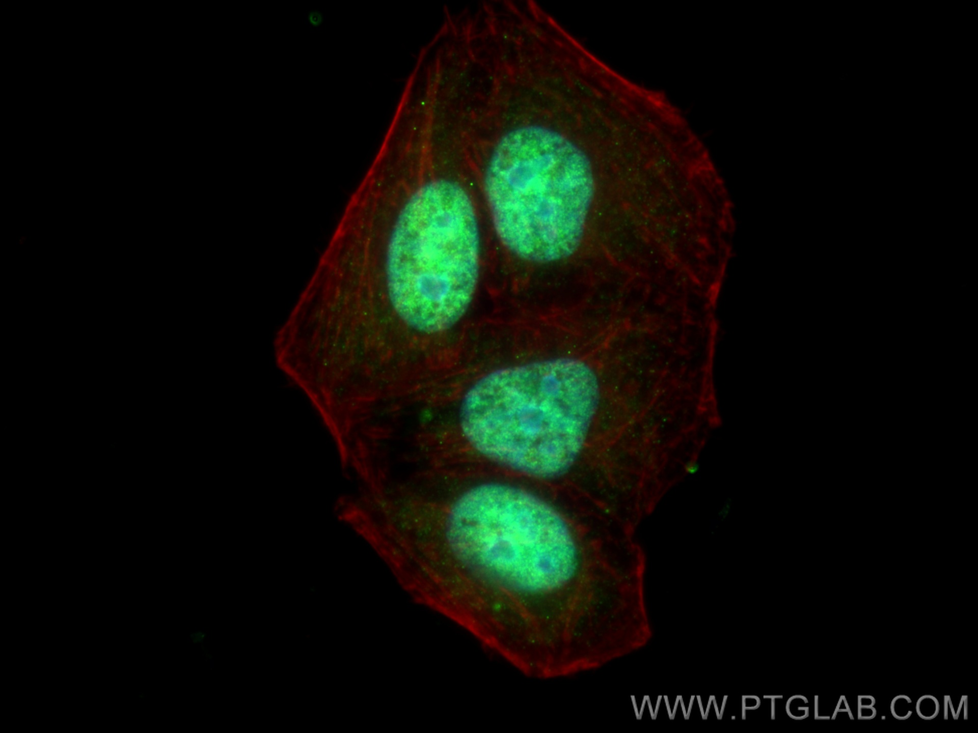 IF Staining of HepG2 using 29980-1-AP