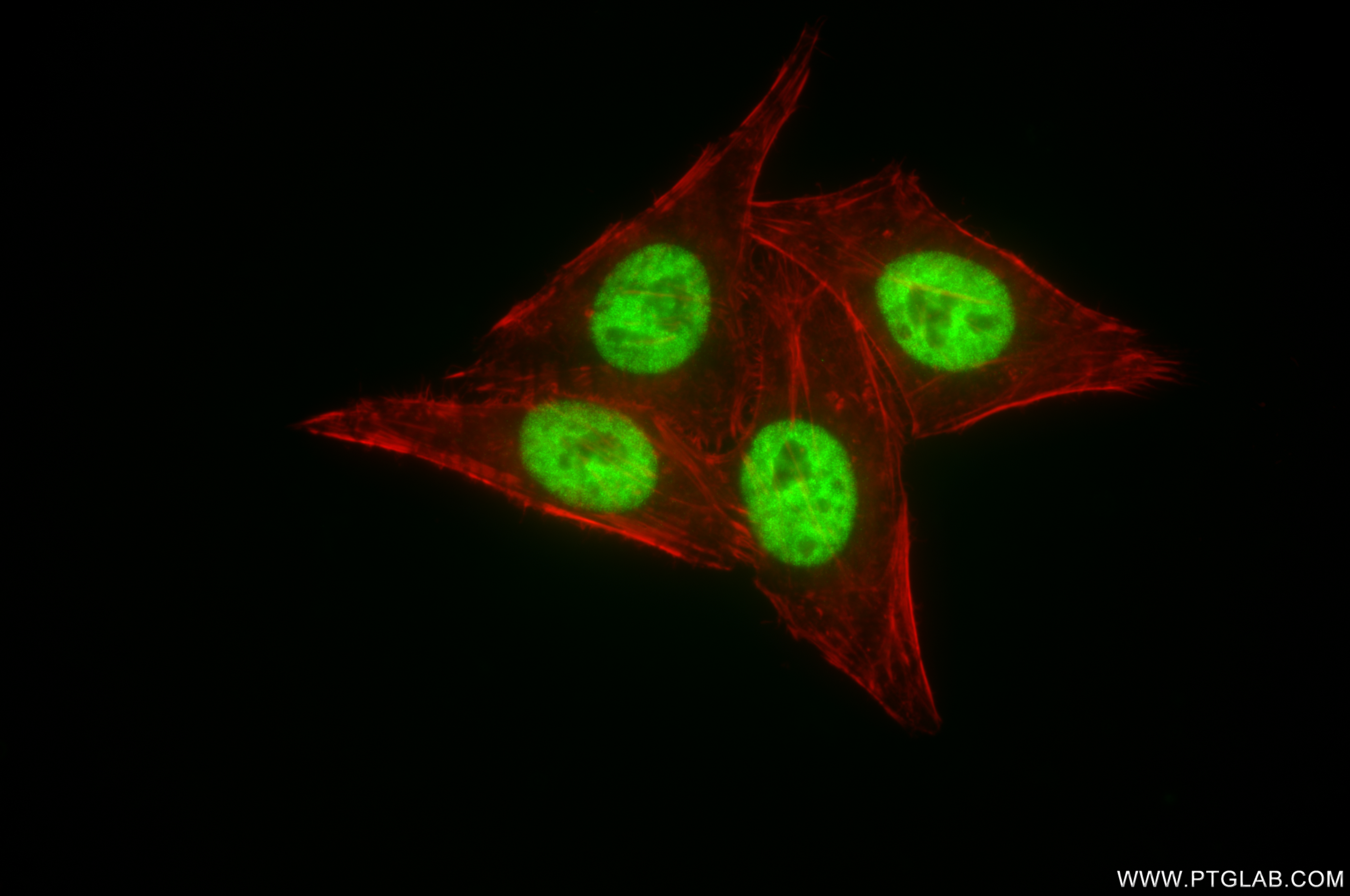 IF Staining of HepG2 using 85078-1-RR (same clone as 85078-1-PBS)