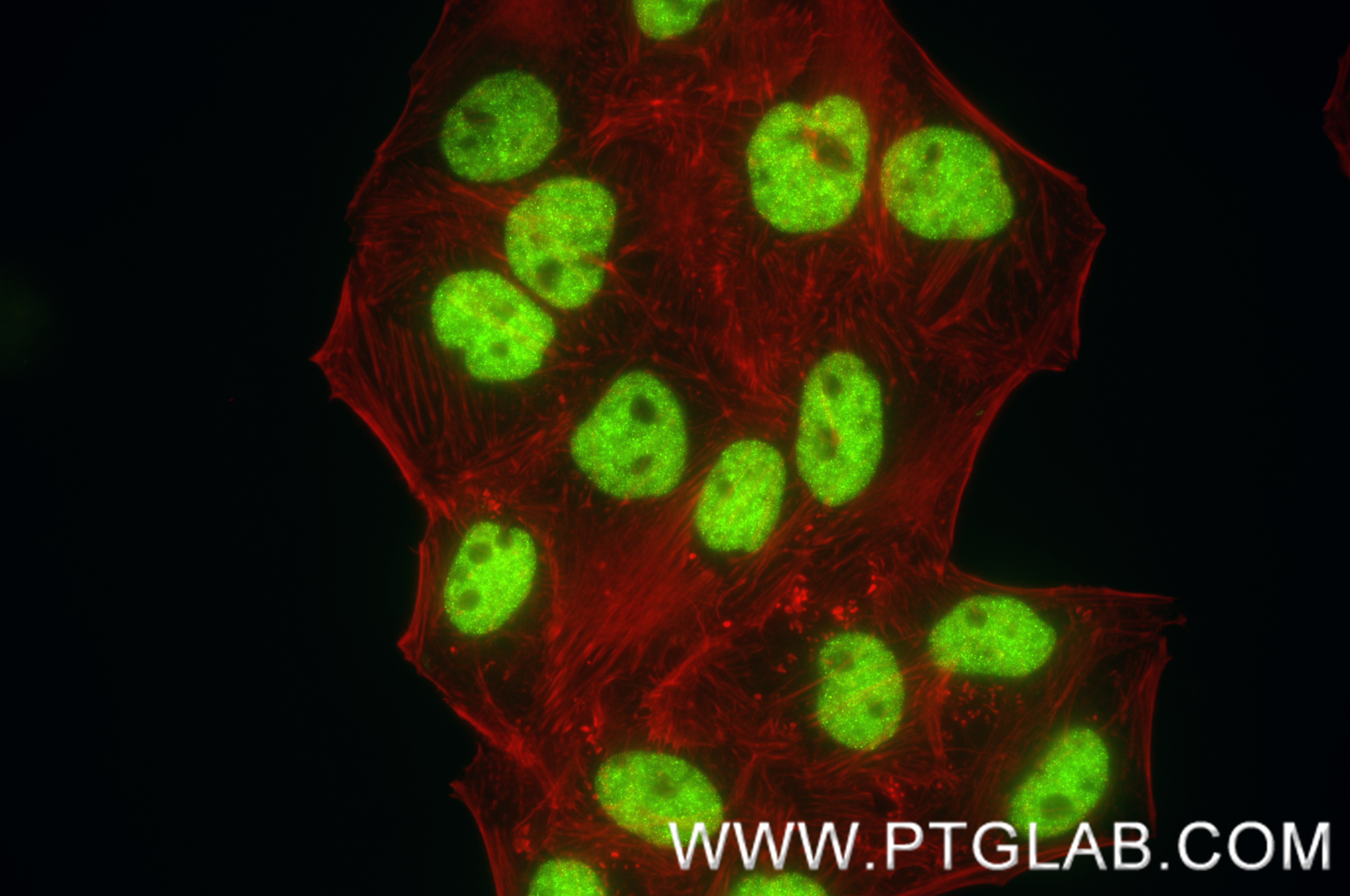 IF Staining of HepG2 using 85078-5-RR (same clone as 85078-5-PBS)