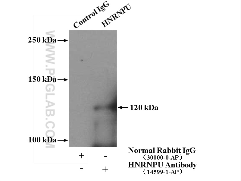 IP experiment of HeLa using 14599-1-AP