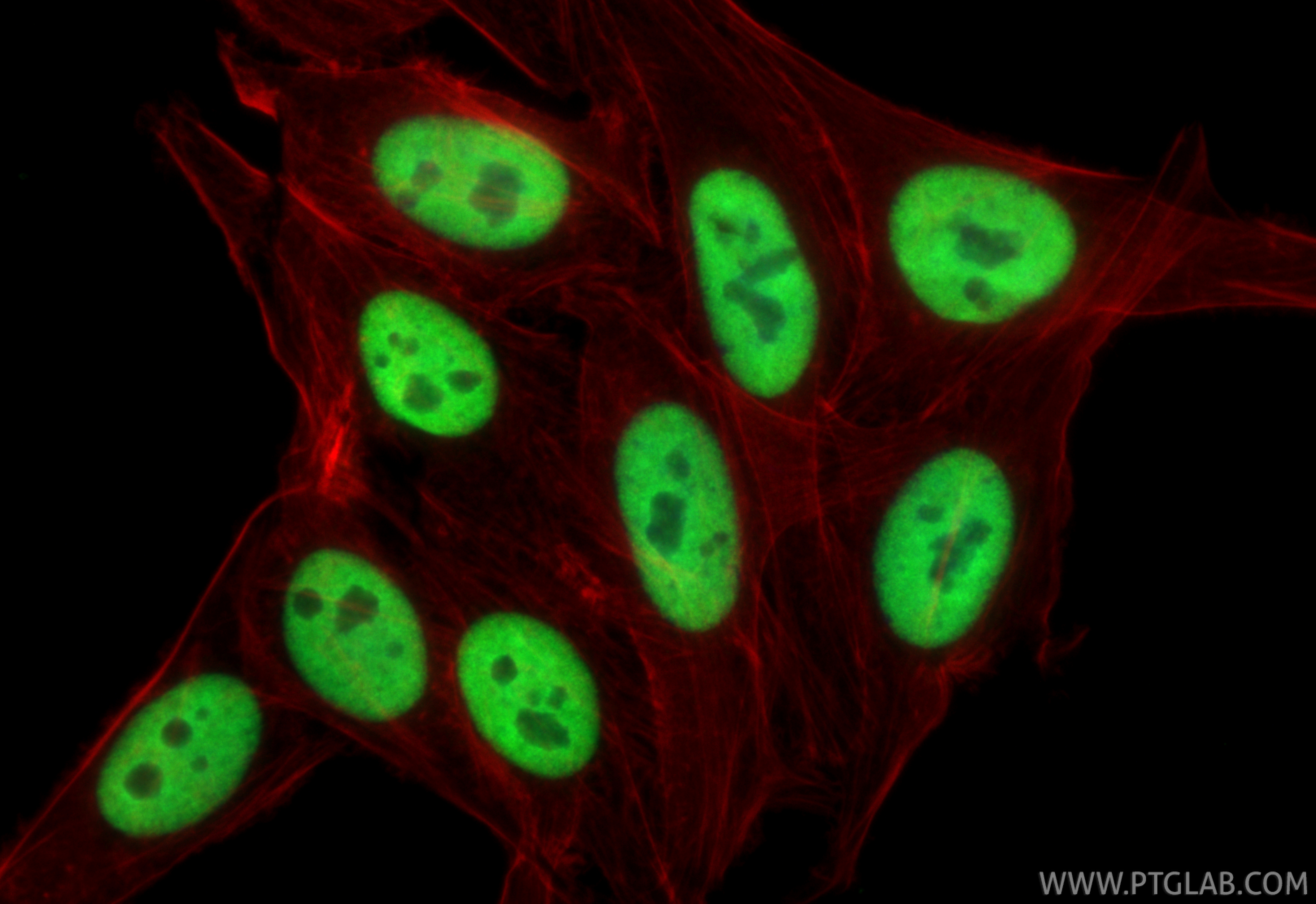 IF Staining of HepG2 using 10578-1-AP