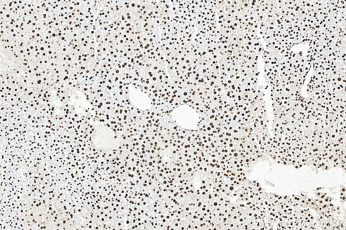IHC staining of mouse liver using 10578-1-AP