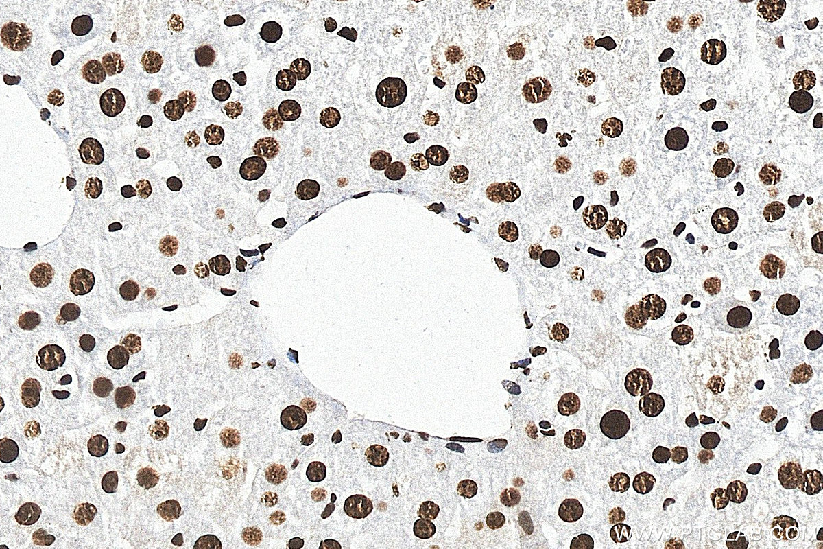 IHC staining of mouse liver using 10578-1-AP