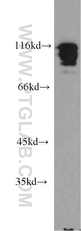 WB analysis of A549 using 10578-1-AP