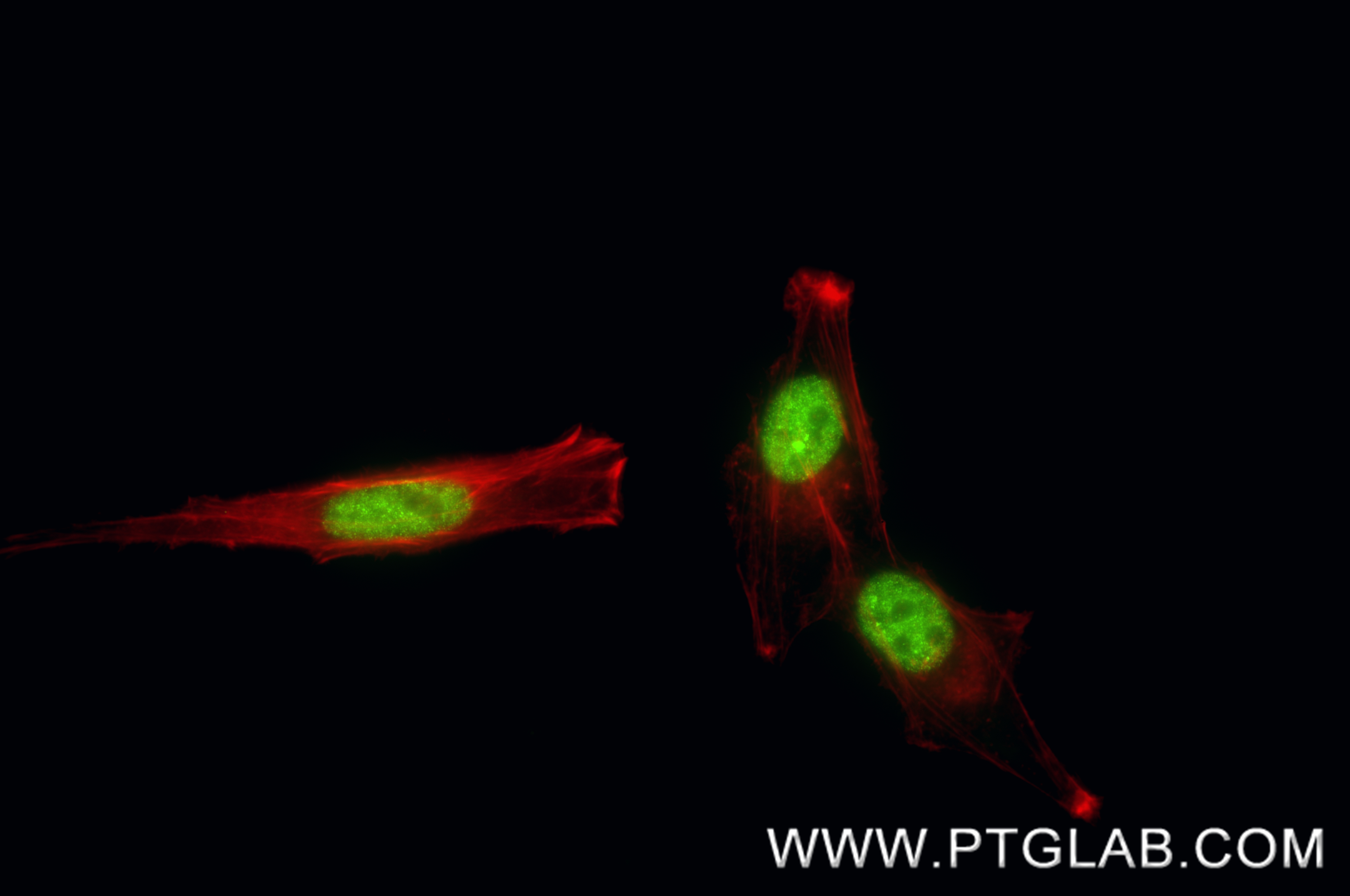 IF Staining of HepG2 using 86926-3-RR (same clone as 86926-3-PBS) IF Staining of HepG2 using 86926-3-RR (same clone as 86926-3-PBS)