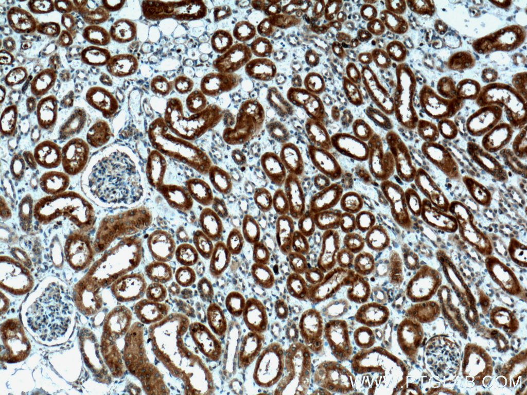 IHC staining of human kidney using 27282-1-AP