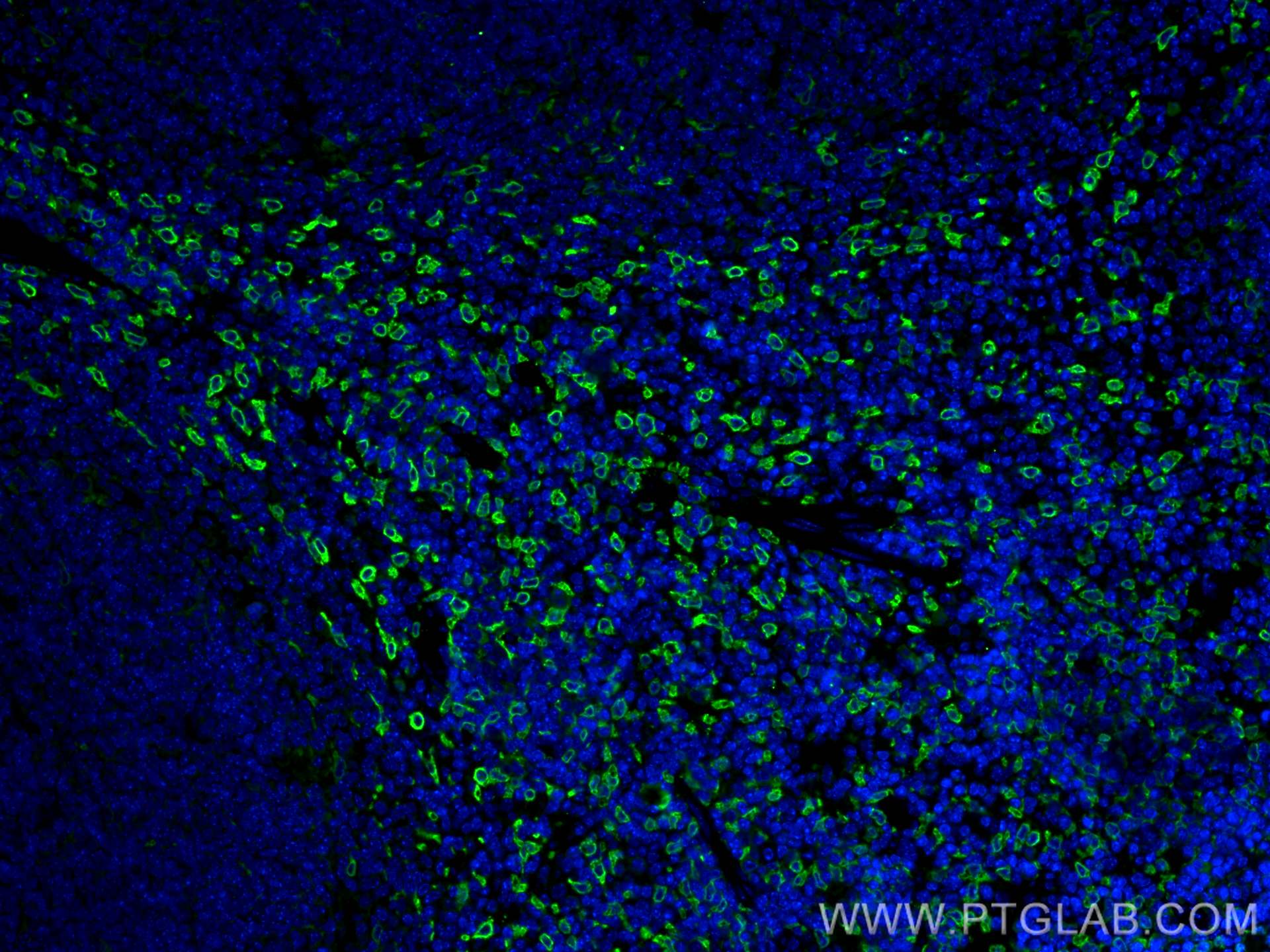 IF Staining of mouse spleen using 66743-1-Ig (same clone as 66743-1-PBS)