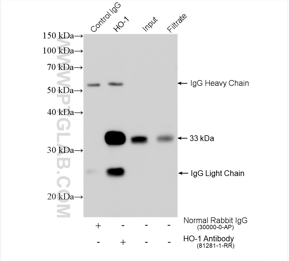 IP experiment of HeLa using 81281-1-RR