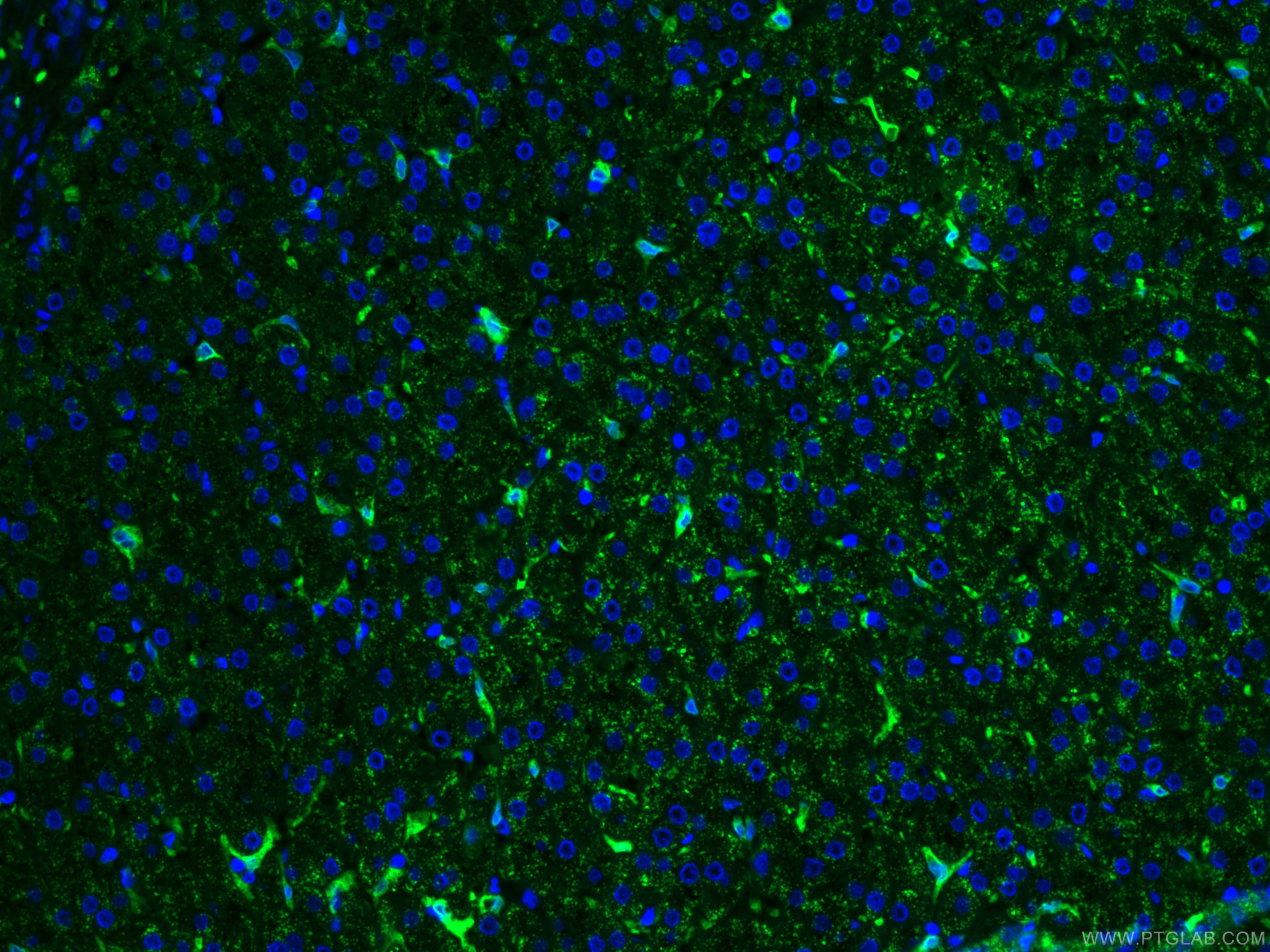 IF Staining of human liver using CL488-66743