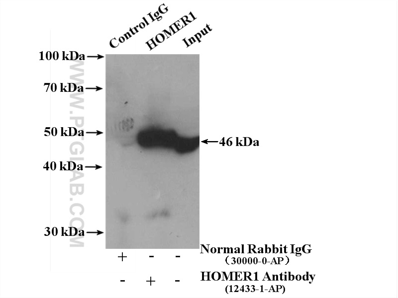 IP experiment of fetal human brain using 12433-1-AP