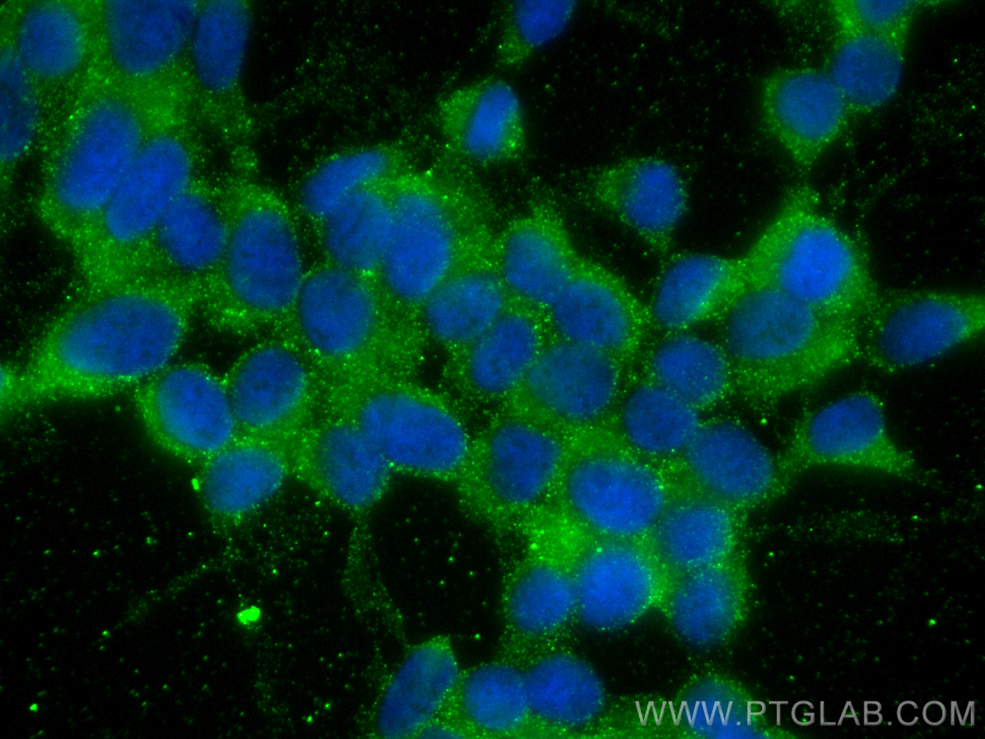 IF Staining of SH-SY5Y using 68597-1-Ig