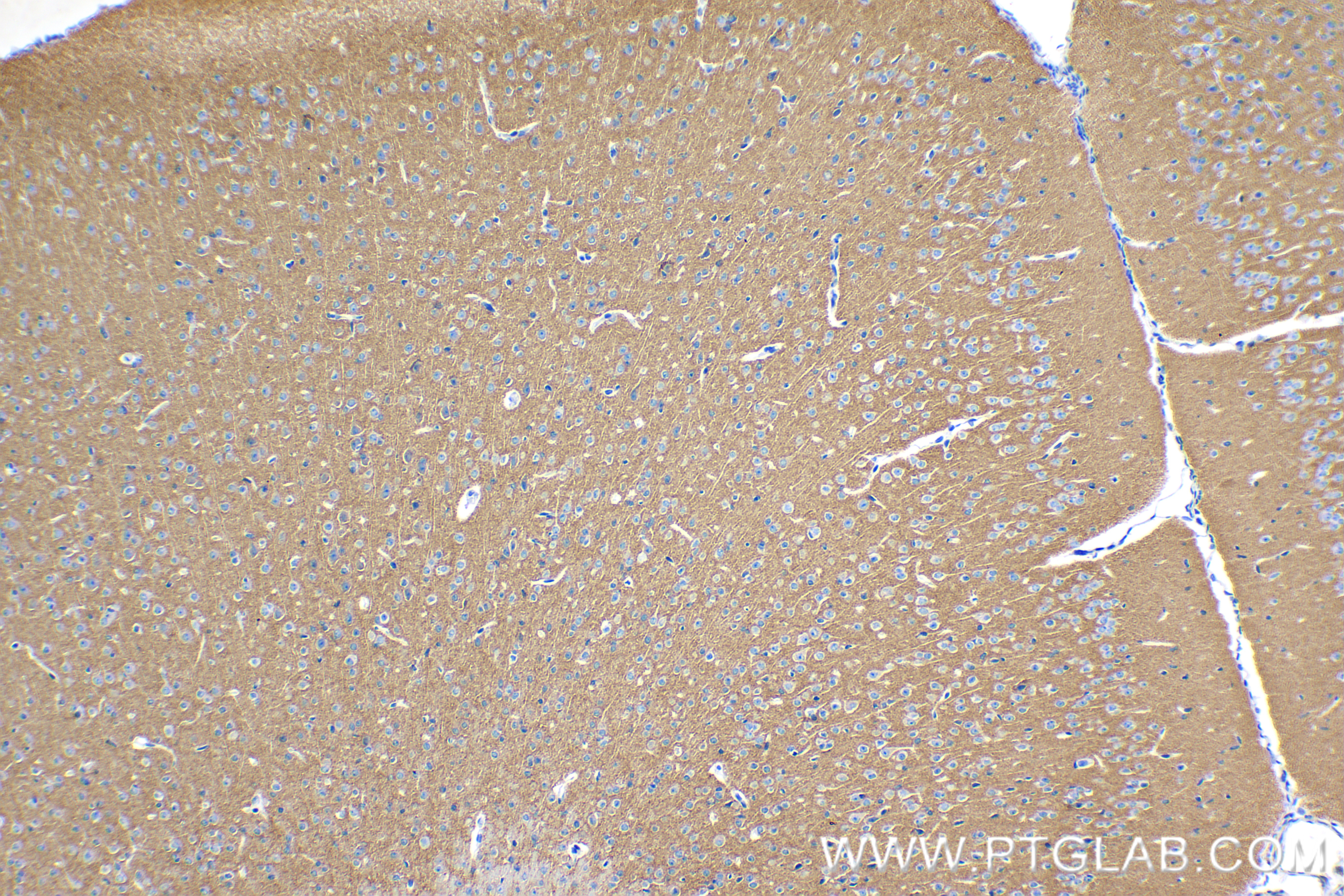 IHC staining of mouse brain using 85692-4-RR